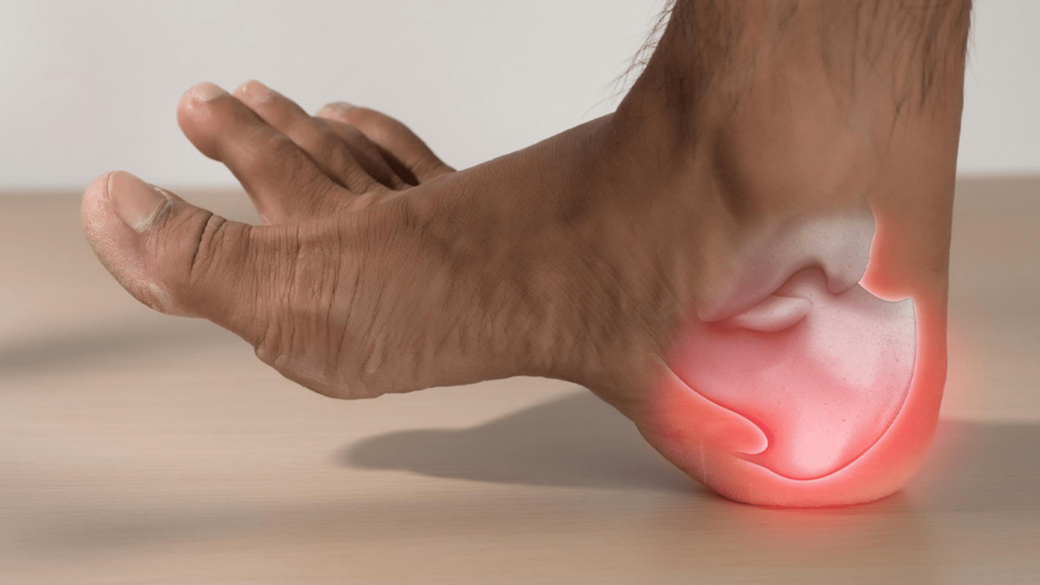 Foot affected by plantar fasciitis, highlighting how barefoot shoes are good for plantar fasciitis