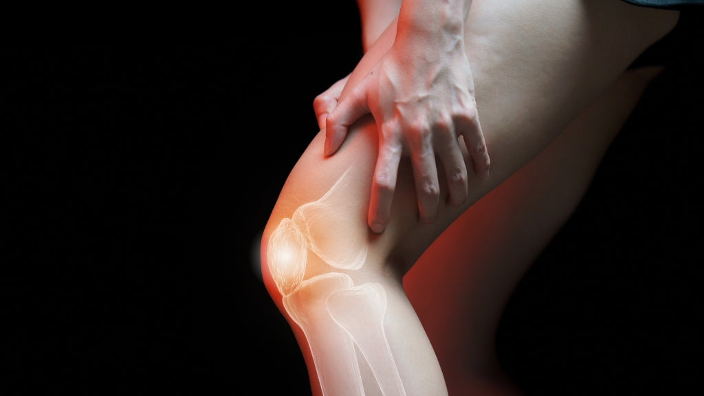 Person in distress holding a painful knee with an anatomical overlay of bones and red inflammation, considering are barefoot shoes good for arthritis.